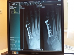IQGEN's maiden health-tech fund strikes debut deal